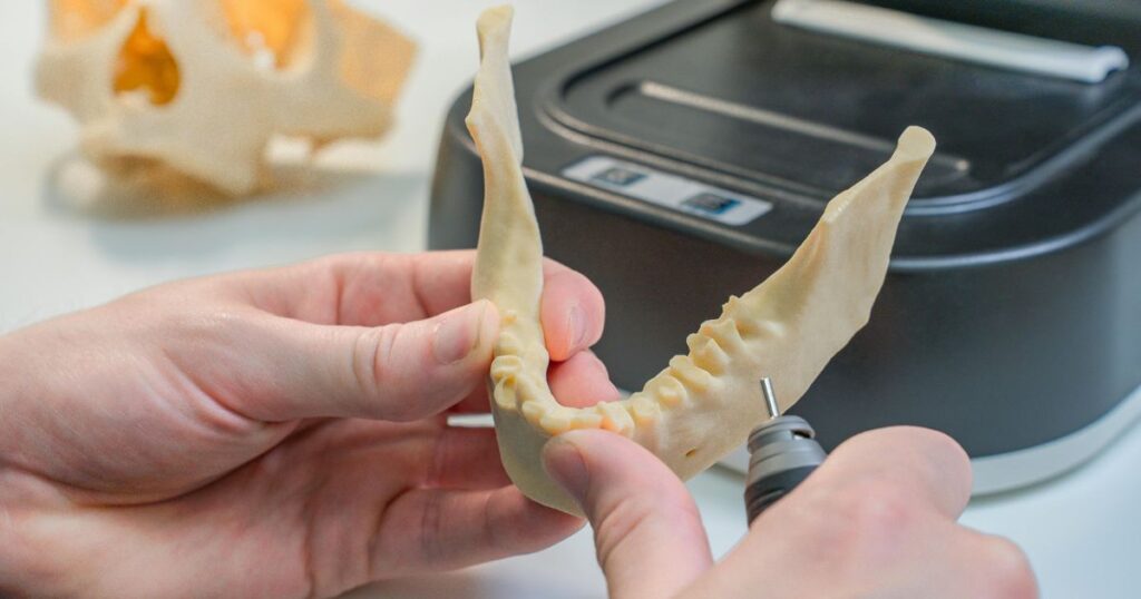 Dental model hasil cetak 3d print