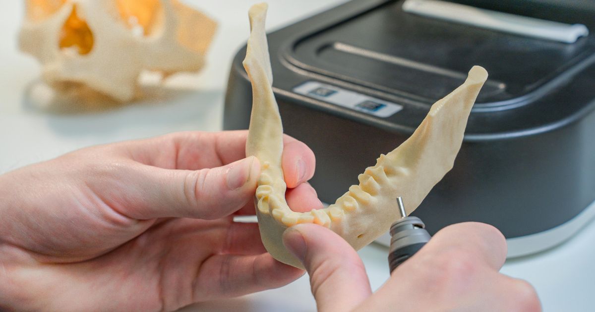 Dental model hasil cetak 3d print